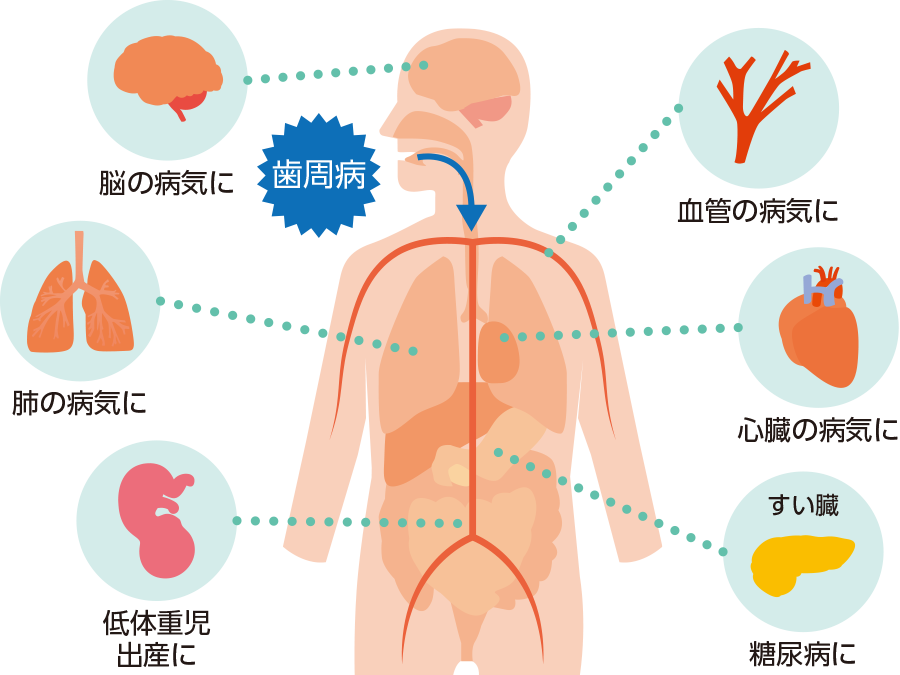 歯周病と全身疾患